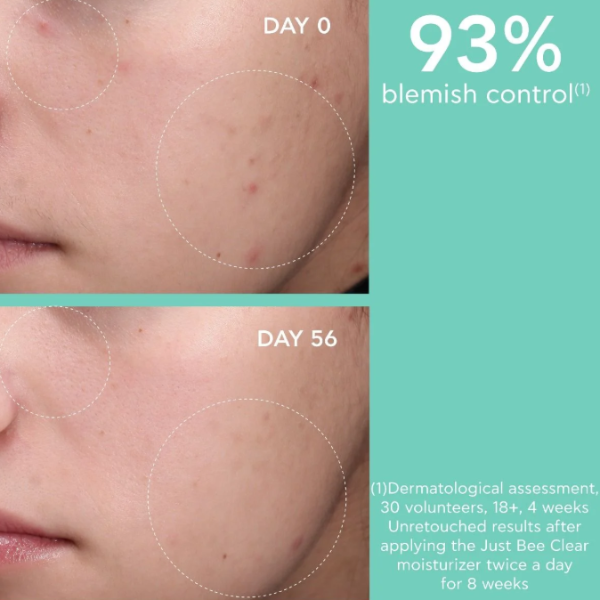 Apivita Just Bee Clear Creme Anti-Imperfeições Hidratante 40ml