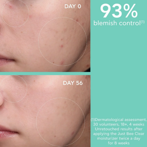 Apivita Just Bee Clear Creme Anti-Imperfeições Hidratante 40ml