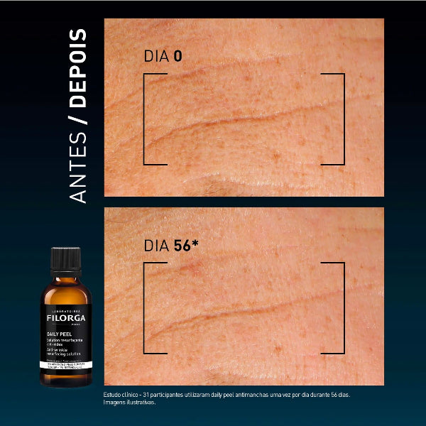 Filorga Daily - Peel Rugas 50ml