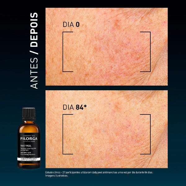 Filorga Daily - Peel Manchas Escuras 50ml